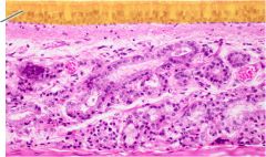which epithelial type is highlighted?