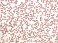 Polychromasia, Elongated cells