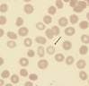 Spiculated cells with numerous short, evenly spaced, blunt to sharp surface projections with uniform size and shape