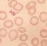 Decreased staining intensity due to insufficient hemoglobin; usually seen with iron deficiency