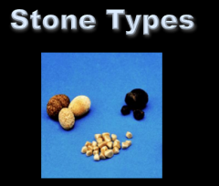 Pure and mixed cholesterol stones
Pigmented stone: brown
Pigmented stone: black