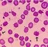 Erythrocytes with one or more surface projections