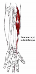 Udspring: Crista supracondylaris lateralis
Hæfte: Basis af 2. metacarpal
Funktion: Extension rad. flexion af håndled. Assisterer i albueflexion