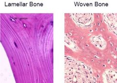 Lamellar
-mature
-perpendicular rows of collagen bundles

Woven
-immature