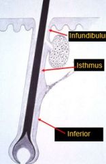 Infundibulum

Isthmus

Inferior

Also, note that the arrector pilli are on an angle.