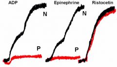 ADP
Epinephrine