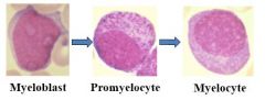 Myeloblasts
Promyelocyte
Myelocyte

Mitotic