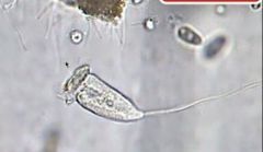 Vorticella 10X, heterotrophic and motile by cilia (40X on the left)