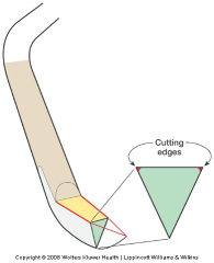 Pointed tip and back
Triangular in cross section
Two cutting edges per working-end