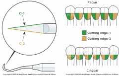 FACIAL - Cutting edge 1 = toward, cutting edge 2 = away
LINGUAL - Cutting edge 1= away, cutting edge 2 = toward
Start at midline of tooth and work toward cole. 
Scale all surface toward or all surfaces away
Make sure to keep 2mm tip adapted and at...