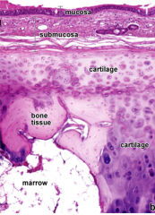C shaped cartilagenous membrane
fibroelastic membrane against esophogeal border


notice ossified cartilage