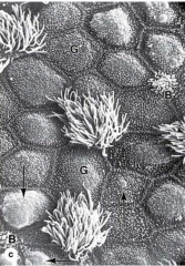 identify the major cell types in this SEM of the bronchus