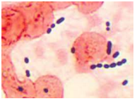 

Group D Streptococcus