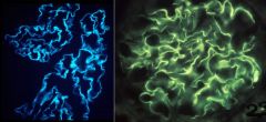 What pattern is seen on immunofluorescence?


 


What is this pattern pathoneumonic of?