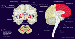 -wilson's disease can cause cystic degeneration of the putamen, as well as damage to other basal ganglia structures

-the putamen is located medial to the insula, and lateral to the globes pallids on coronal sections