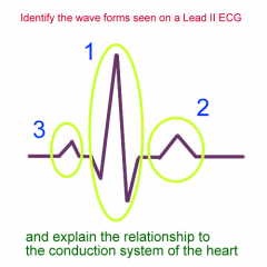 Which wave of the cardiac cycle is depicted by #2?