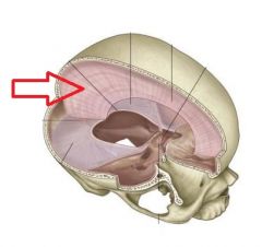 This dural septa is found in the longitudinal fissure. It seperates the right and left hemispheres of the brain and attaches inferiorly to the crista galli of the ethmoid bone.
