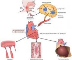 Mitral regurgitation due to rheumatic heart disease