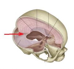 This dural septa is found between the right & left hemispheres of the cerebellum in the posterior cerebellar notch.
