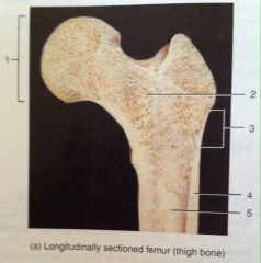 Femur (thigh bone)