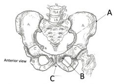 Identify if the pelvic girdle is female or male, give 2 reasons why?
