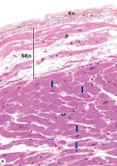 label this cardiac tissue image