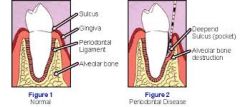 the bone surrounding the roots of teeth