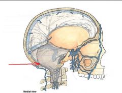 This dural venous sinus is found just inferior to the occipital lobe & the cerebellum. It drains into the confluence of sinuses.