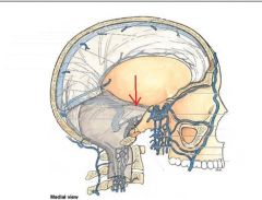 This dural venous sinus is located beneath the brain. It receives drainage from the cavernous sinus and flows backward and laterally to drain into the transverse sinus.