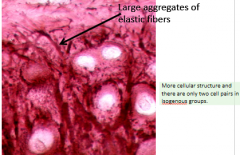 Matrix Contains Elastic Fibers


1. Located: Auricle of Ear, Eustachian Tubes, Epiglottis, and Larynx
2. More cells/matrix than hyaline
3. Isogenous groups have only two cells