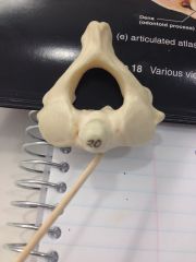 which vertebra is this?
 
And what is it pointing to?