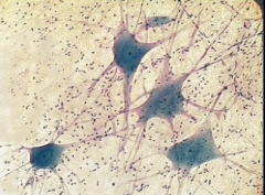 What are the functions of the tiny little dots surrounding the neuron? 