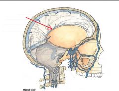 Inferior Sagittal Sinus 