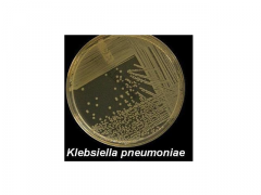 Nutrient agar


Kan bakterien vokse uden specifikke vækstfaktorer (blod, serum)


Fx Staph Aureus, Klebsiella pneumoniae, Salmonella typhimurium