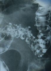 What is this an x-ray of and how do you know?