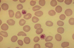 What are the characteristics of these platelets?