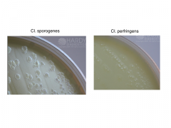Om bakterien kan fraspalte fedtsyrer (lecitinase)


Hvid zone omkring koloni: positiv 


Fx Bacillus cereus