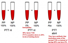 Mixing Studies for Inhibitor:
- Only do this test if there is an abnormal PTT or PT to identify it due to antibodies