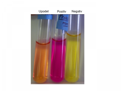 Urea omdannes til CO2 og ammoniak (urease) -> stigning i pH


Pink/lilla: positiv fx Klebsiella pneumoniae


Orange: upodet


Gul: negativ