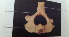 What is the name of this vertebra?