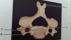 What kind of vertebra is this?