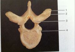 What kind of vertebra is this?