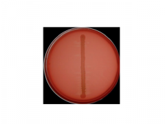 Nogle bakterier kan ikke selv syntetisere NAD (V-faktor) og er afhængig af at en anden bakterie (eller værten) leverer denne vigtige co-faktor
Fx Actinobacillus pleuropneumoniae



Man kan dyrke bakterien på chokoladeagar (lyseret blod agar), e...