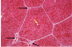 lobule surrounded by connective tissue with the triads on the periphery (black arrows) and the central 
vein in the middle (yellow arrow).