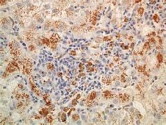 Describe what you see in this liver slide?


What is staining in the hepatocytes?