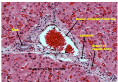 Notice the portal venuole is much larger than the rest of the structures and it is surrounded by endothelial cells. 

The hepatic arterial is much smaller and is surrounded by endothelial cells and smooth muscle 
cells. Both the venuole and the...