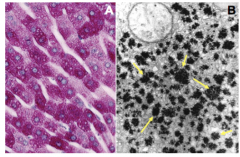 Glycogen is stored in the hepatocytes. The purple on the left and the black on the right is glycogen. 

Larger clumps are called alpha glycogen and smaller spots are called beta glycogen.