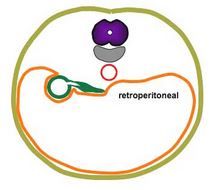 Retroperitoneal