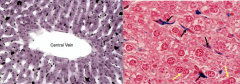The two pictures below are showing more Kupffer cells. 

Kupffer cells can be seen in the left pic as black dots in the sinusoids since they phagocytized India ink. The right pic show Kupffer cells after they have phagocytized trypan blue (black...