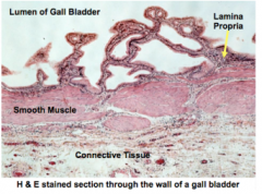 The epithelium of the gall bladder is very folded as you can see to the right and the gall bladder is surrounded by smooth muscle. This smooth muscle can contract to squeeze out bile when triggered by 
cholecystokinin. 

Remember that the gall ...